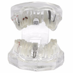 SILVER GRILLZ SINGLE  2 ROW