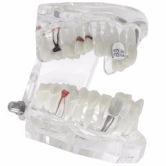 SILVER GRILLZ SINGLE  2 ROW