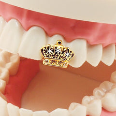 GOLD GRILLZ SINGLE TOOTH CROWN