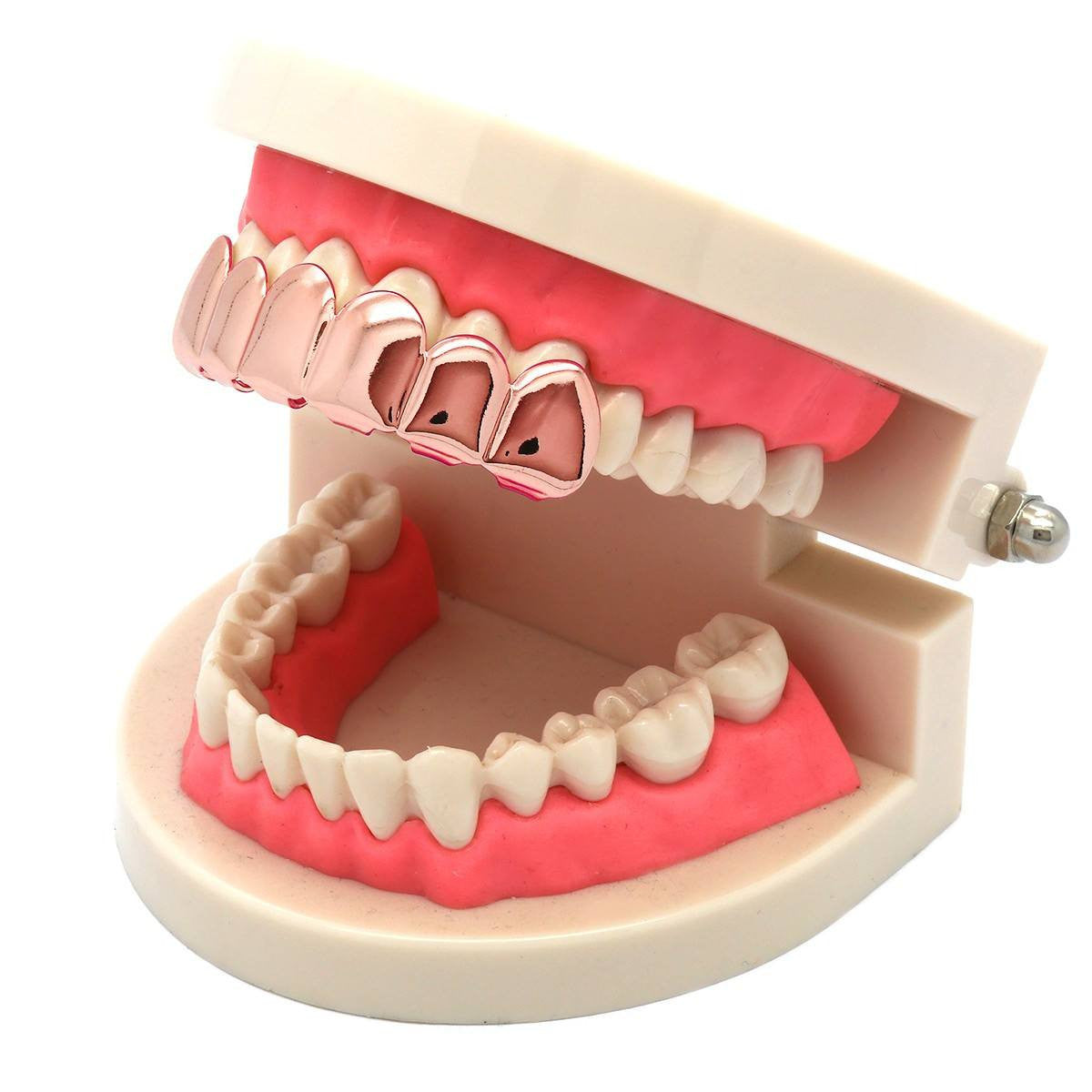 ROSE GOLD TOP GRILLZ