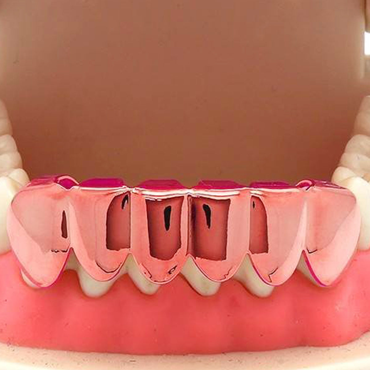 ROSE GOLD BOTTOM GRILLZ