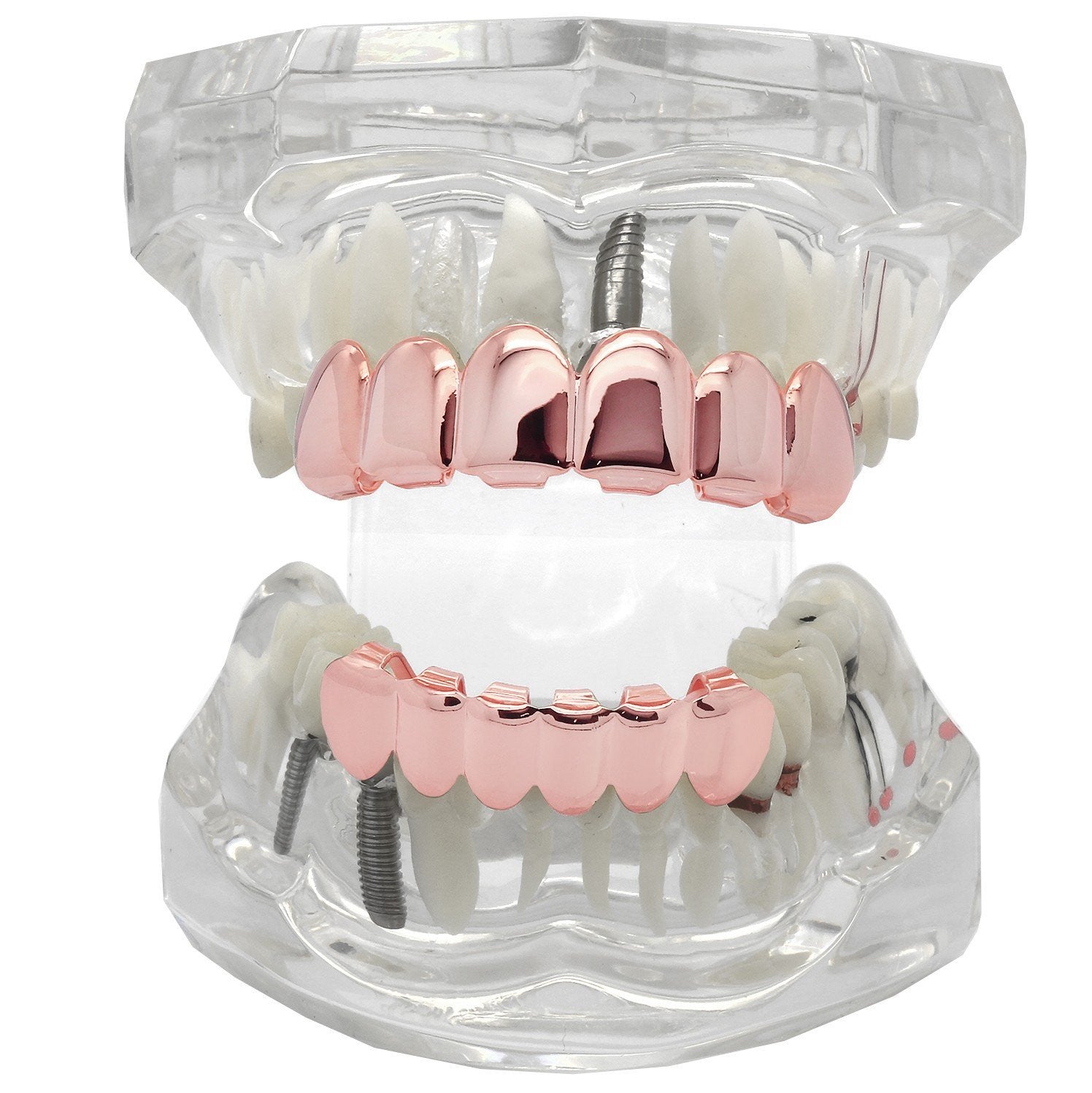 Grillz Set Rose Plain KINGSTAR
