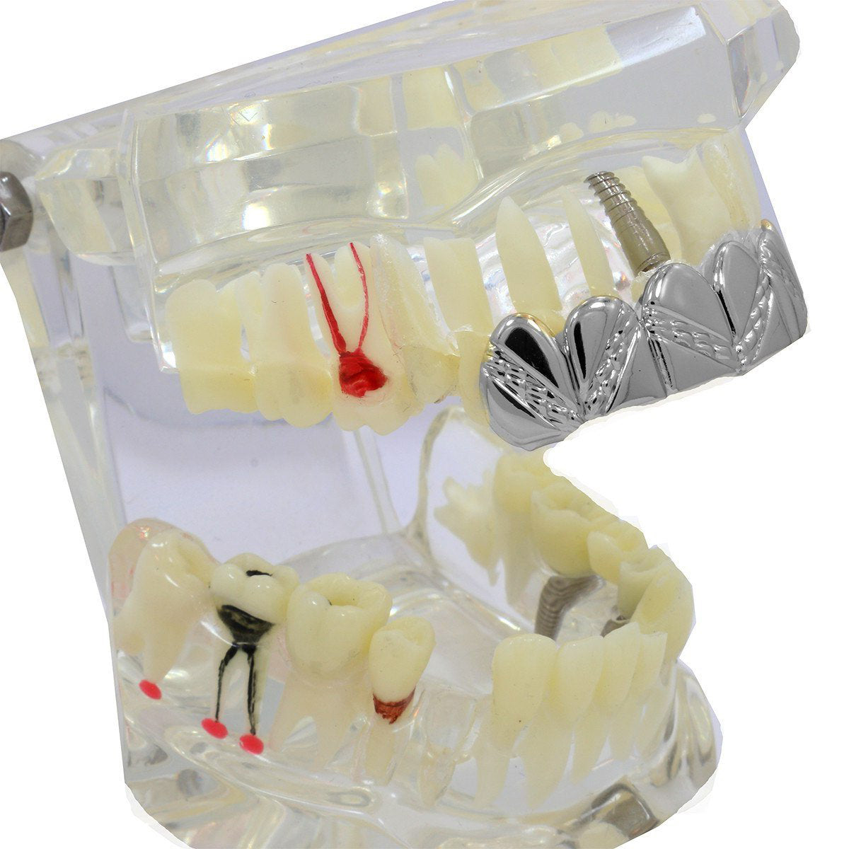 SILVER TOP GRILLZ ZIG ZAG