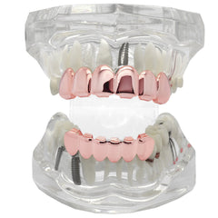 GRILLZ SET ROSE GOLD PLAIN BEST