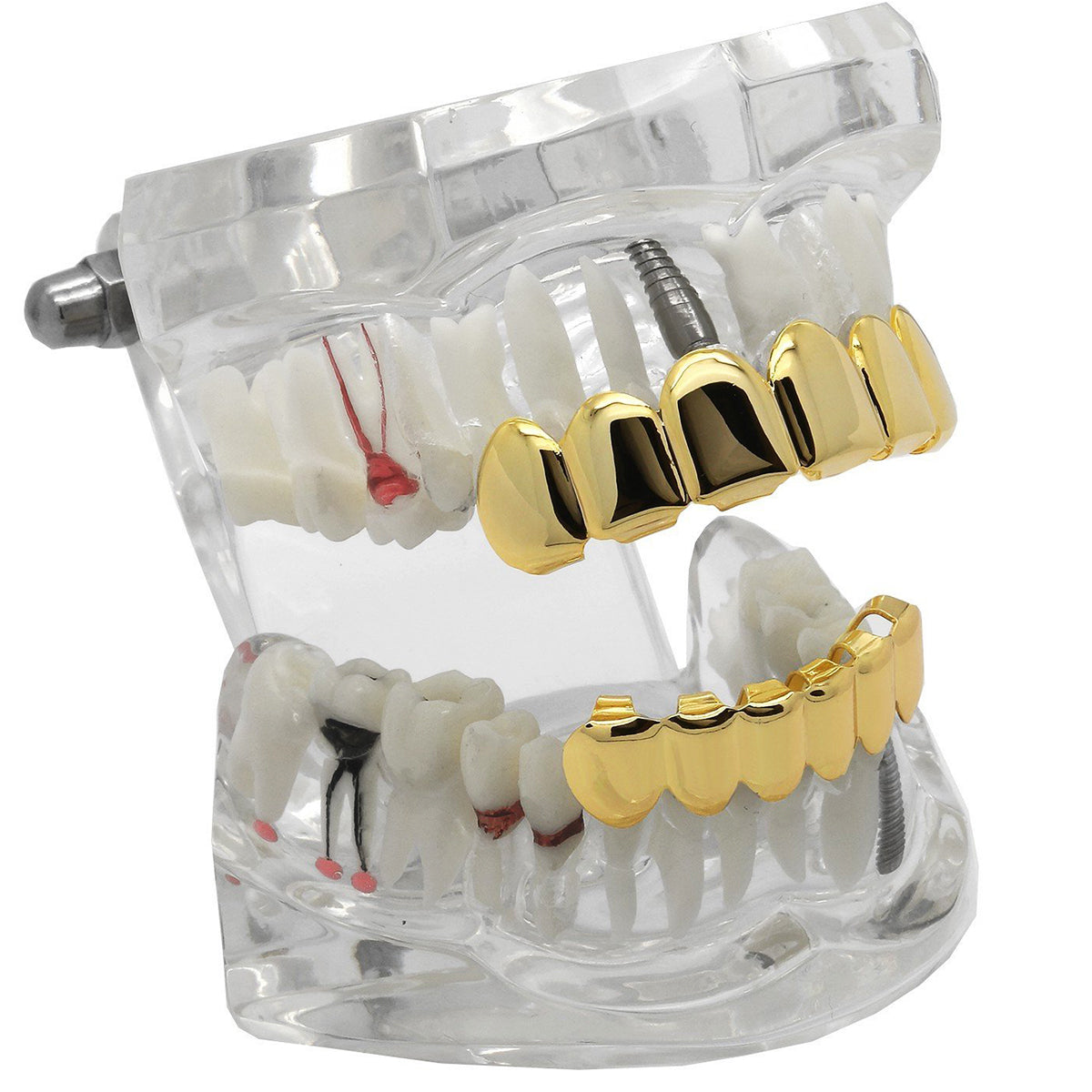 GRILLZ SET GOLD PLAIN