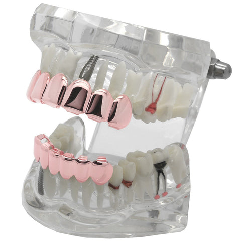 GRILLZ SET ROSE GOLD PLAIN BEST