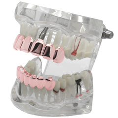 GRILLZ SET ROSE GOLD PLAIN BEST