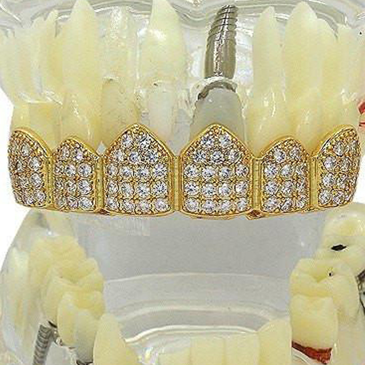 GOLD TOP GRILLZ CZ