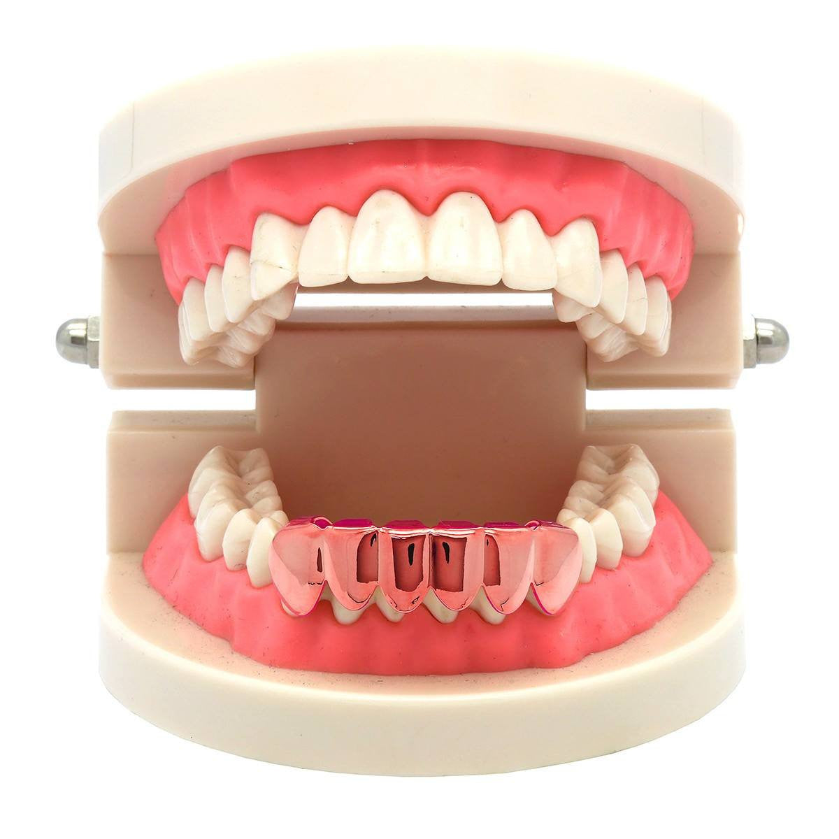 ROSE GOLD BOTTOM GRILLZ