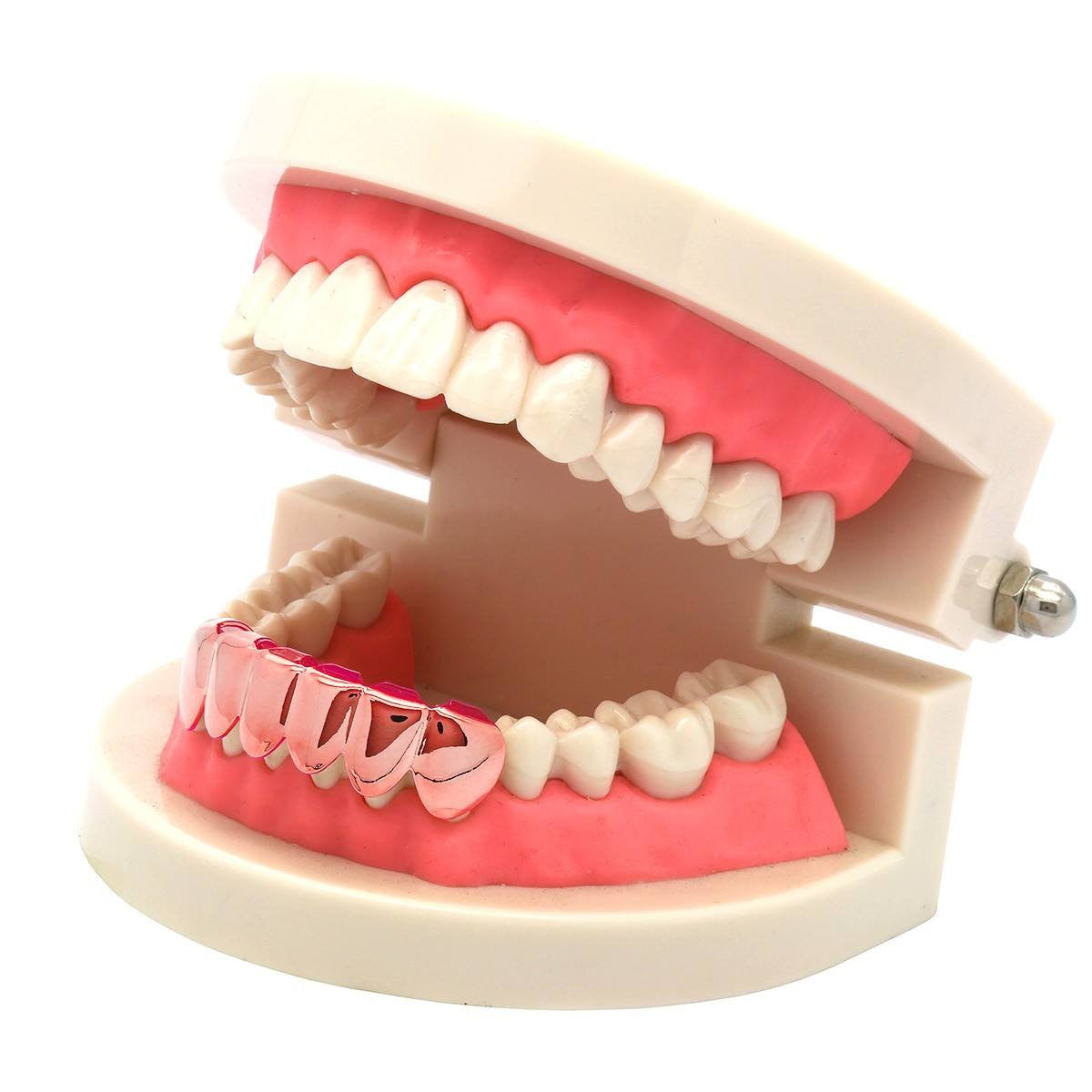 ROSE GOLD BOTTOM GRILLZ