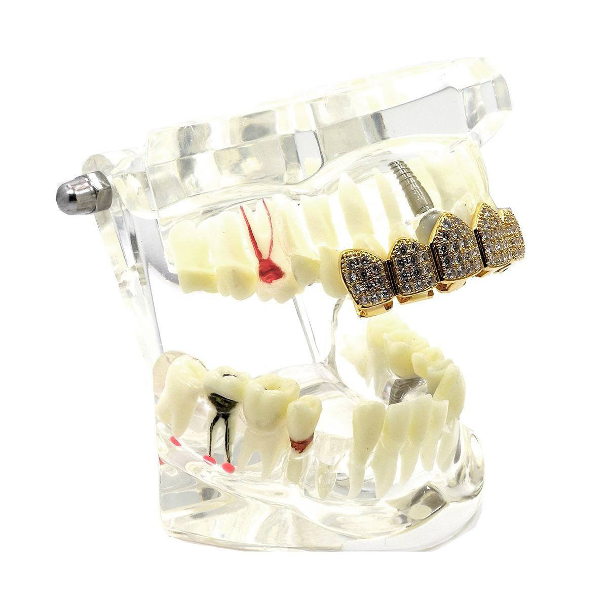 GOLD TOP GRILLZ CZ