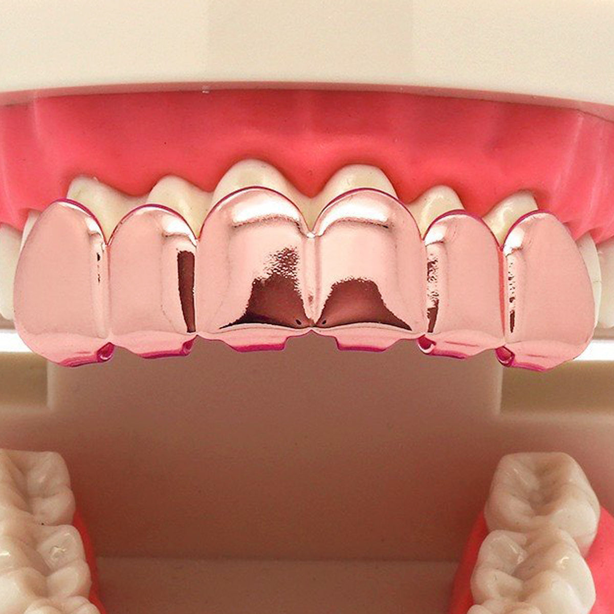 ROSE GOLD TOP GRILLZ