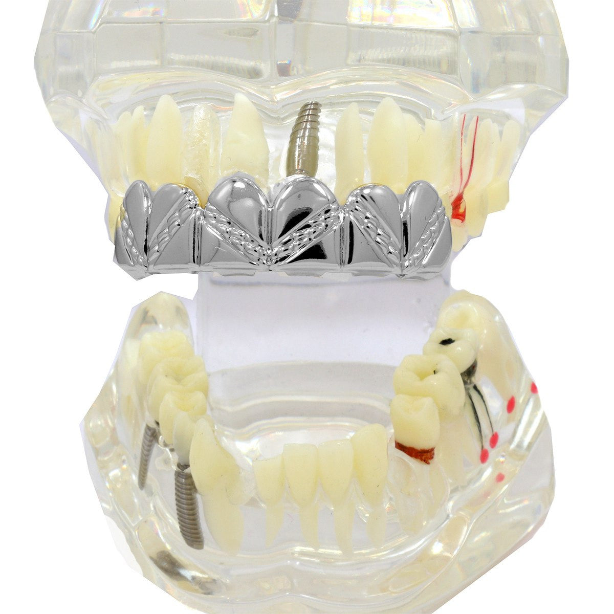 SILVER TOP GRILLZ ZIG ZAG