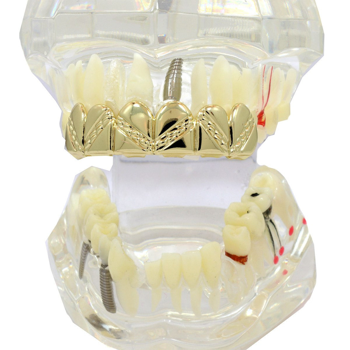 GOLD TOP GRILLZ ZIG ZAG