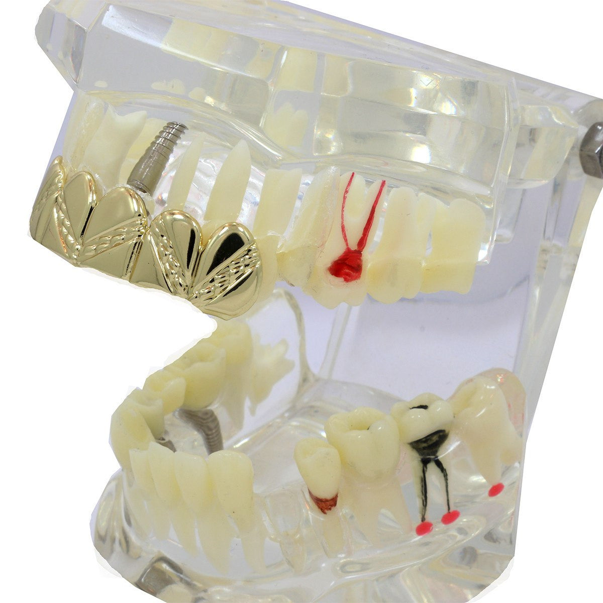 GOLD TOP GRILLZ ZIG ZAG