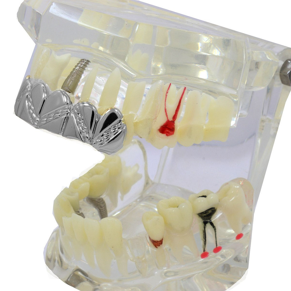 SILVER TOP GRILLZ ZIG ZAG