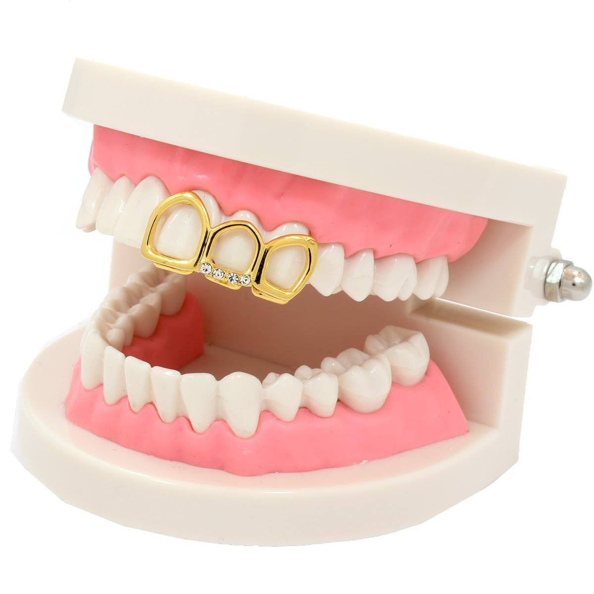 GOLD TOP GRILLZ 3 TOOTH OPEN