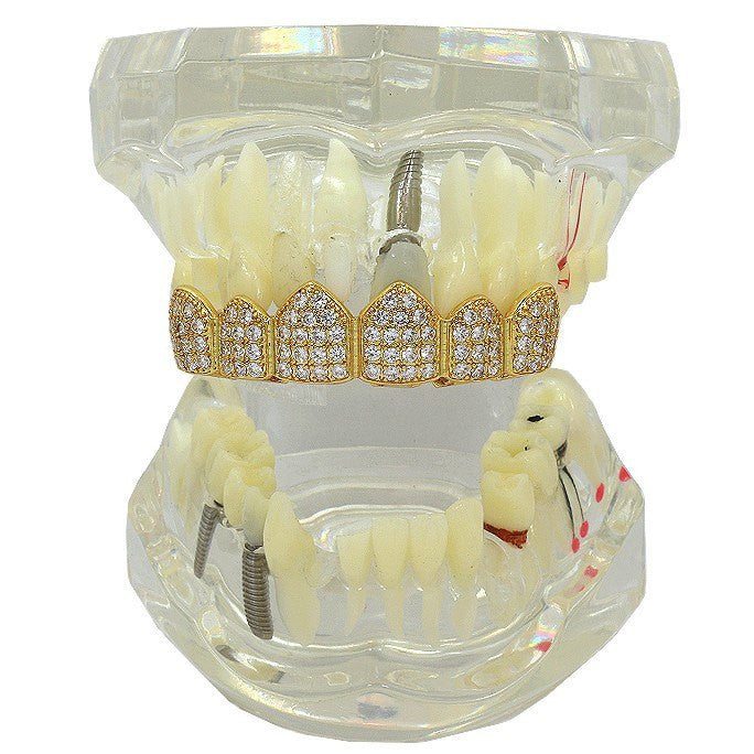 GOLD TOP GRILLZ CZ