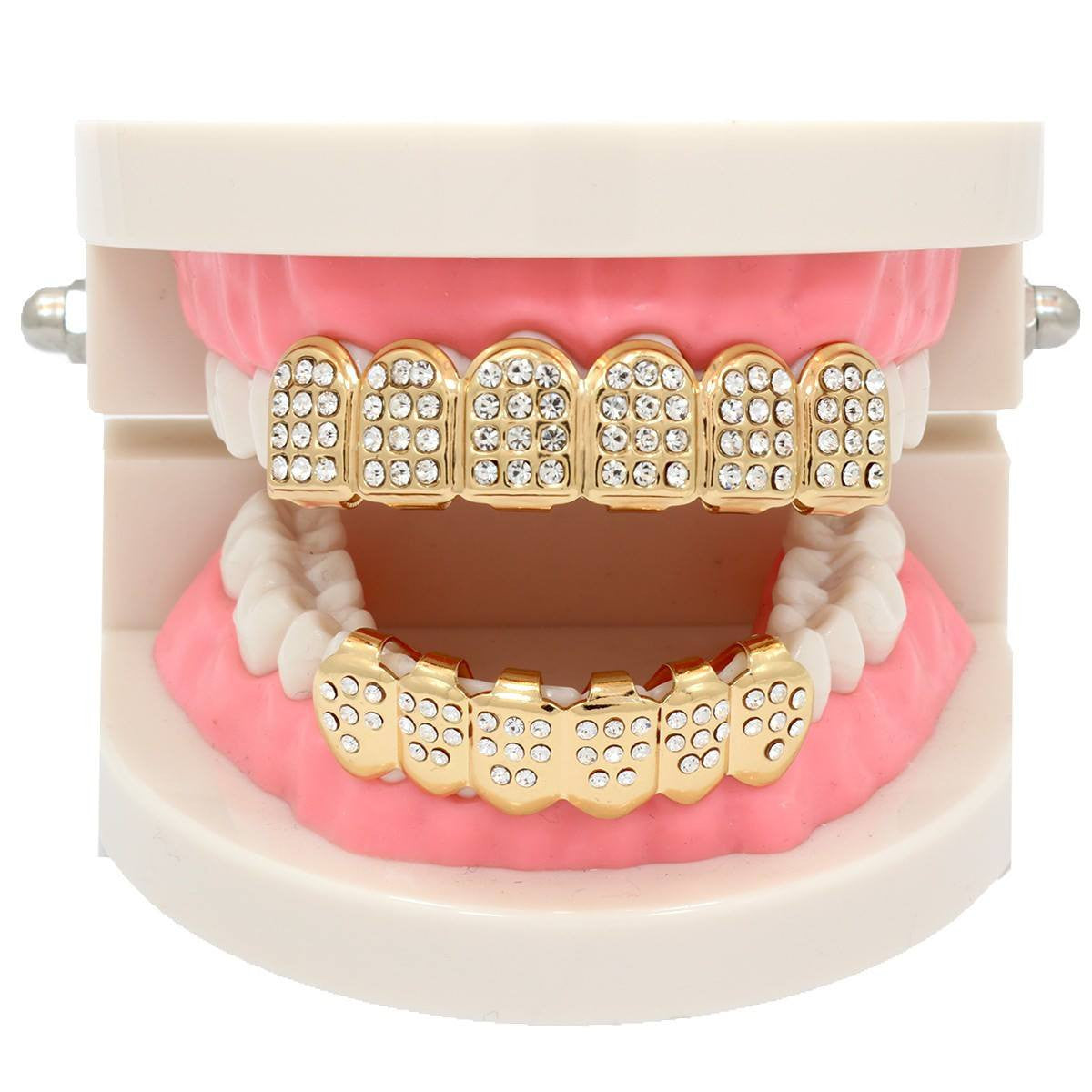 GOLD D SHAPE FULLY ICED TOP AND BOTTOM SET