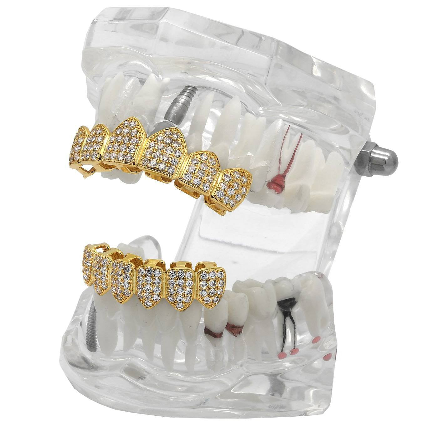 GRILLZ SET GOLD CZ FULLY ICED OUT