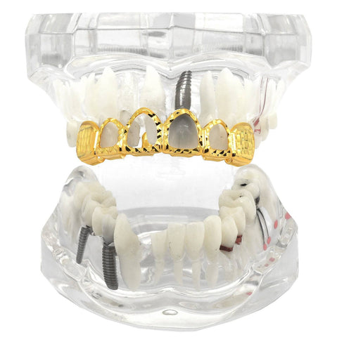 GOLD TOP GRILLZ 4 OPEN DIAMOND CUT