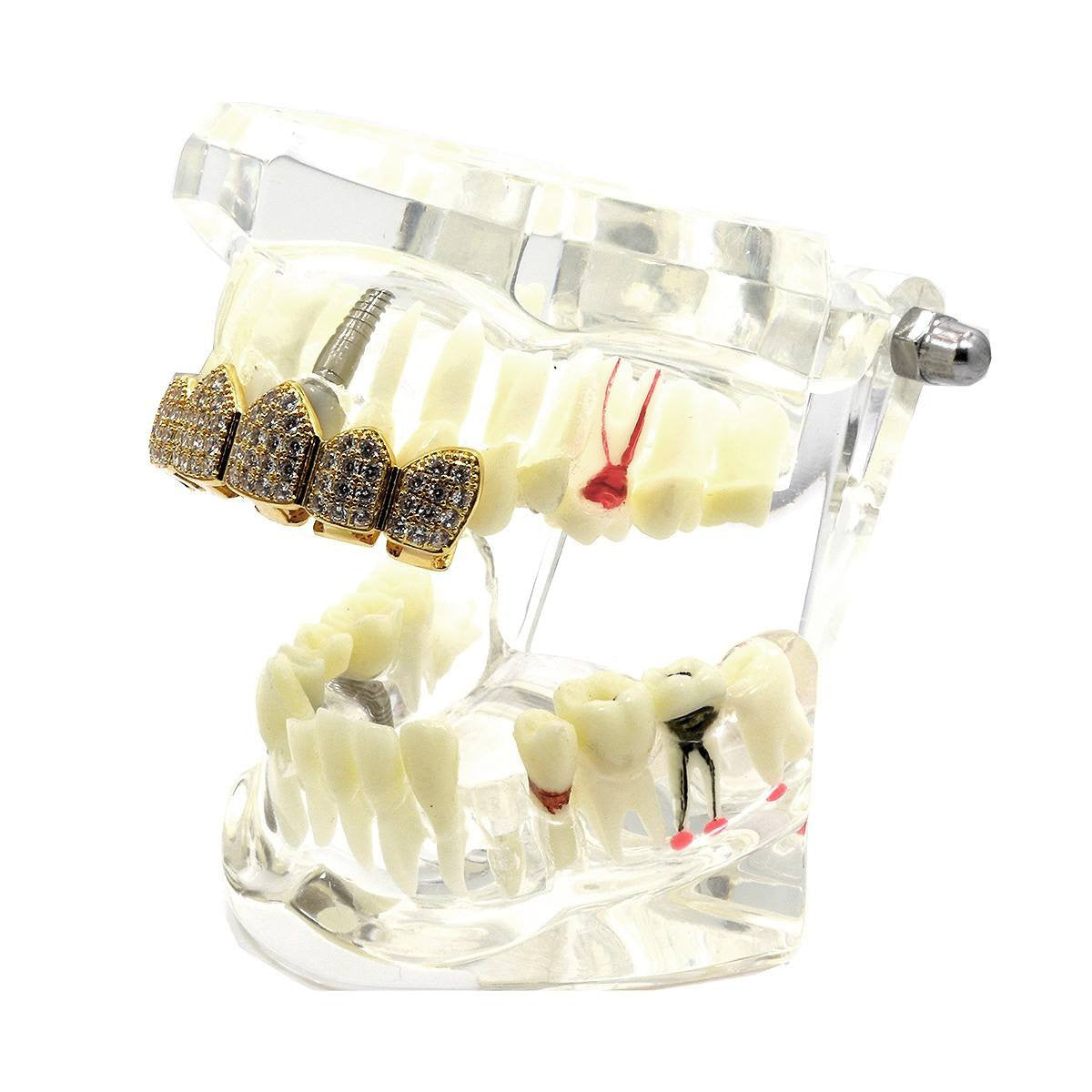 GOLD TOP GRILLZ CZ