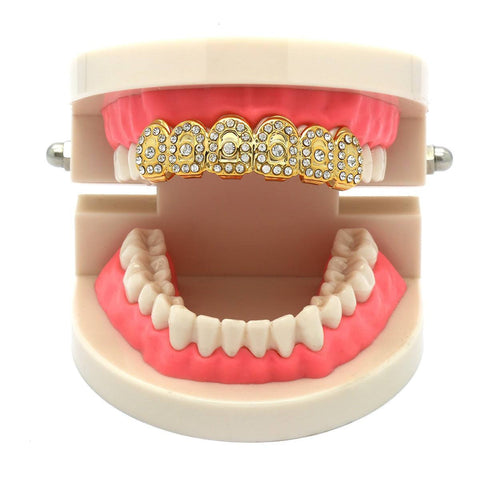 GOLD TOP GRILLZ CROWN